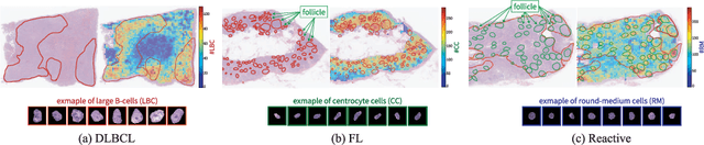 Figure 1 for Explainable Classifier for Malignant Lymphoma Subtyping via Cell Graph and Image Fusion