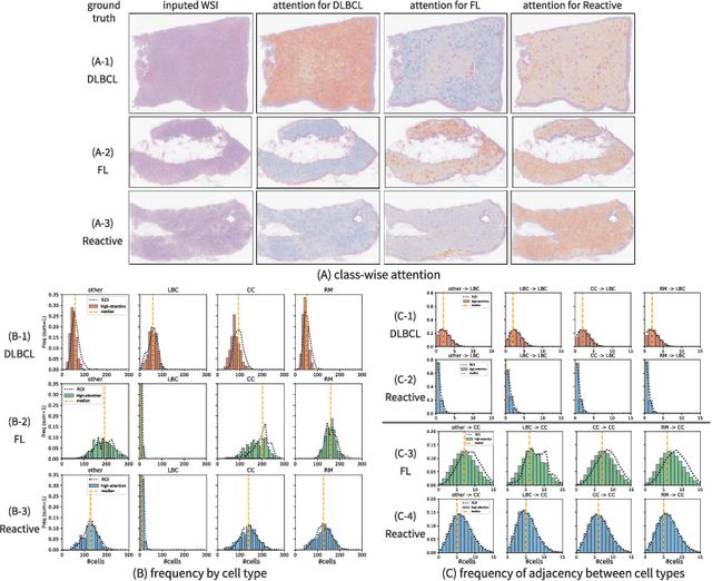Figure 4 for Explainable Classifier for Malignant Lymphoma Subtyping via Cell Graph and Image Fusion