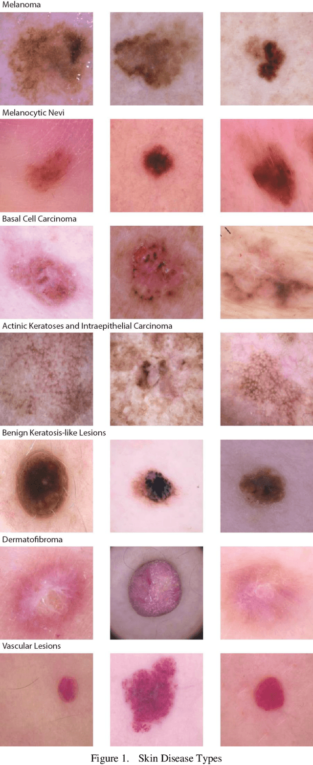 Figure 1 for Enhancing Skin Lesion Diagnosis with Ensemble Learning