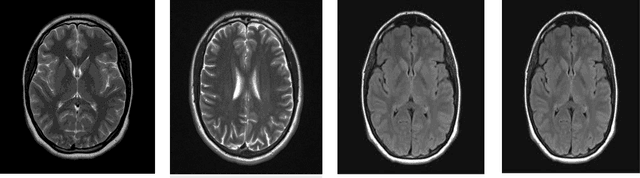 Figure 1 for Brain Tumor Classification using Vision Transformer with Selective Cross-Attention Mechanism and Feature Calibration