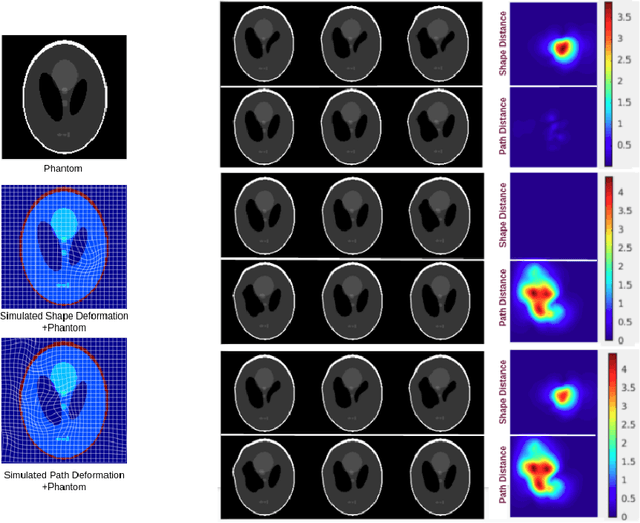 Figure 3 for A metric to compare the anatomy variation between image time series