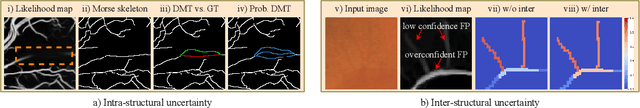 Figure 3 for Topology-Aware Uncertainty for Image Segmentation