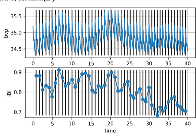 Figure 3 for Automatic pain recognition from Blood Volume Pulse (BVP) signal using machine learning techniques