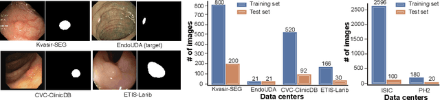 Figure 1 for A Client-server Deep Federated Learning for Cross-domain Surgical Image Segmentation