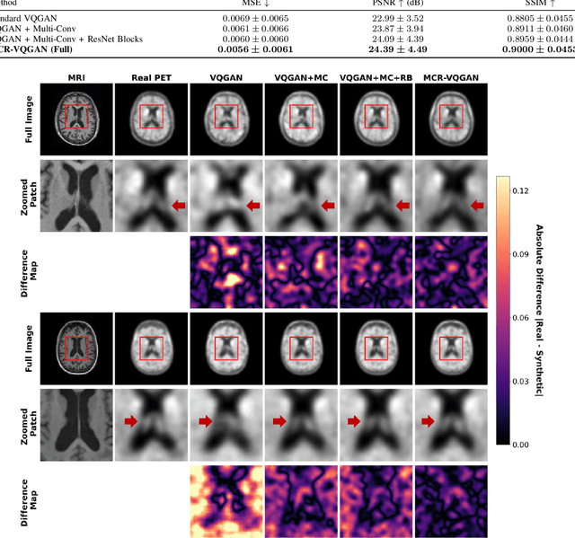Figure 2 for MCR-VQGAN: A Scalable and Cost-Effective Tau PET Synthesis Approach for Alzheimer's Disease Imaging