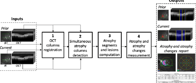 Figure 3 for Simultaneous column-based deep learning progression analysis of atrophy associated with AMD in longitudinal OCT studies