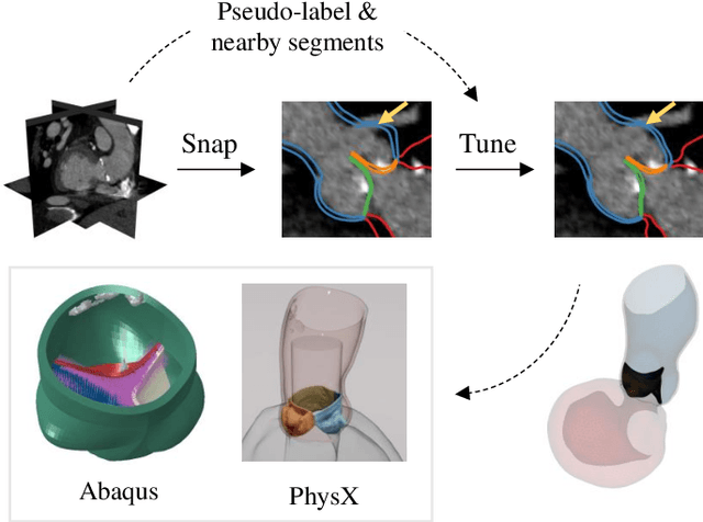 Figure 1 for Snap-and-tune: combining deep learning and test-time optimization for high-fidelity cardiovascular volumetric meshing