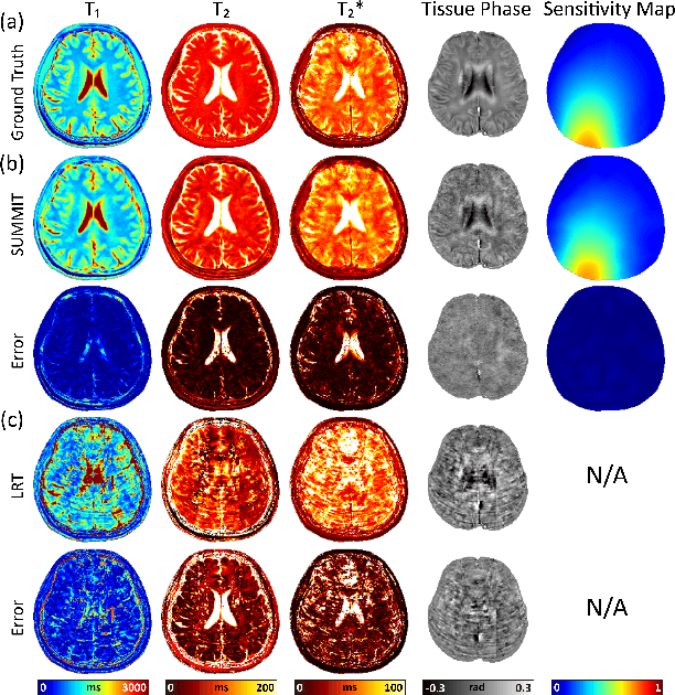Figure 4 for Coordinate-Based Neural Representation Enabling Zero-Shot Learning for 3D Multiparametric Quantitative MRI