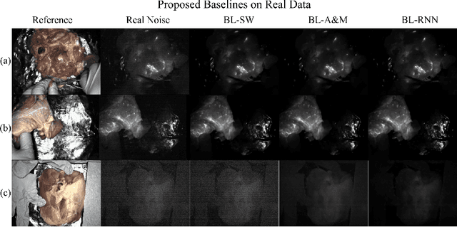 Figure 2 for Video Denoising in Fluorescence Guided Surgery