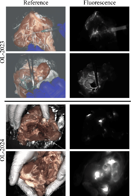 Figure 3 for Video Denoising in Fluorescence Guided Surgery