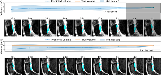 Figure 4 for CUTE-MRI: Conformalized Uncertainty-based framework for Time-adaptivE MRI