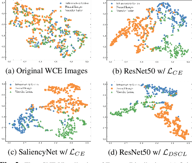 Figure 4 for Learn From Zoom: Decoupled Supervised Contrastive Learning For WCE Image Classification