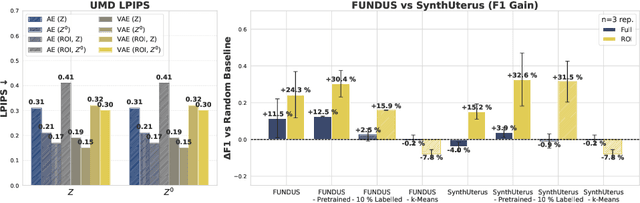 Figure 3 for Diffusing the Blind Spot: Uterine MRI Synthesis with Diffusion Models