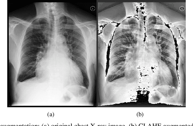 Figure 1 for Towards Precision Healthcare: Robust Fusion of Time Series and Image Data