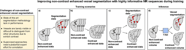 Figure 1 for Improving Vessel Segmentation with Multi-Task Learning and Auxiliary Data Available Only During Model Training