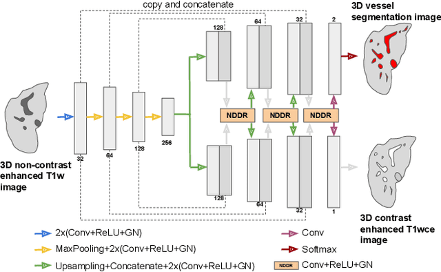 Figure 3 for Improving Vessel Segmentation with Multi-Task Learning and Auxiliary Data Available Only During Model Training