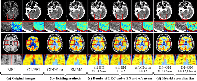 Figure 1 for Rethinking Normalization Strategies and Convolutional Kernels for Multimodal Image Fusion