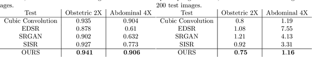 Figure 3 for Learning-based Framework for US Signals Super-resolution