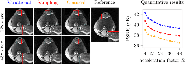 Figure 3 for Resolution-Robust 3D MRI Reconstruction with 2D Diffusion Priors: Diverse-Resolution Training Outperforms Interpolation