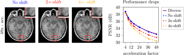 Figure 1 for Resolution-Robust 3D MRI Reconstruction with 2D Diffusion Priors: Diverse-Resolution Training Outperforms Interpolation