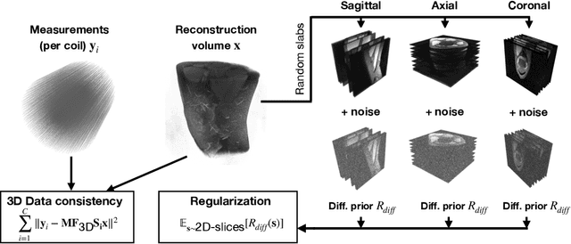 Figure 2 for Resolution-Robust 3D MRI Reconstruction with 2D Diffusion Priors: Diverse-Resolution Training Outperforms Interpolation
