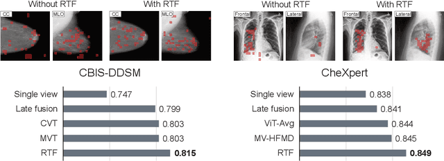 Figure 1 for Random Token Fusion for Multi-View Medical Diagnosis