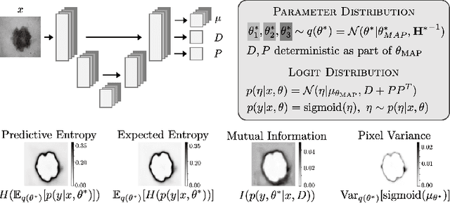 Figure 1 for Laplacian Segmentation Networks: Improved Epistemic Uncertainty from Spatial Aleatoric Uncertainty