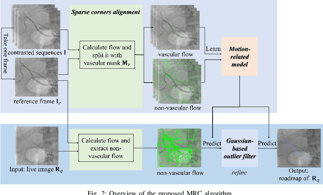 Figure 2 for Optical flow-based vascular respiratory motion compensation