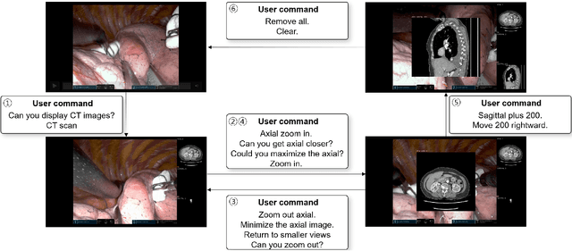 Figure 4 for Surgical Agent Orchestration Platform for Voice-directed Patient Data Interaction