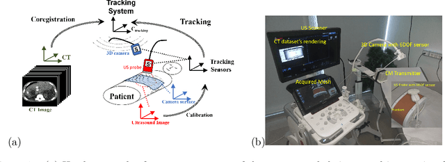 Figure 1 for US & MR Image-Fusion Based on Skin Co-Registration