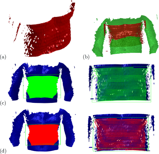Figure 4 for US & MR Image-Fusion Based on Skin Co-Registration