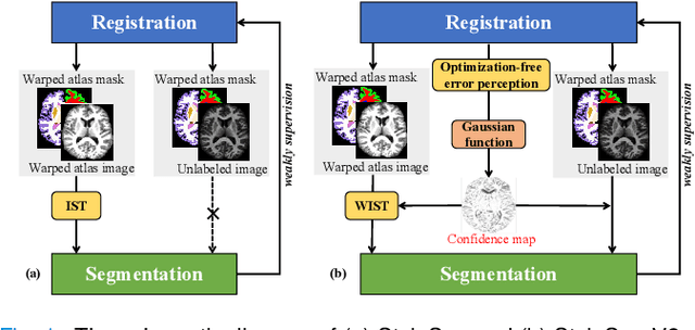 Figure 1 for StyleSeg V2: Towards Robust One-shot Segmentation of Brain Tissue via Optimization-free Registration Error Perception