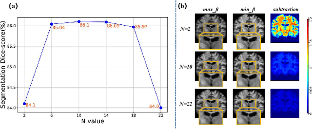 Figure 2 for StyleSeg V2: Towards Robust One-shot Segmentation of Brain Tissue via Optimization-free Registration Error Perception