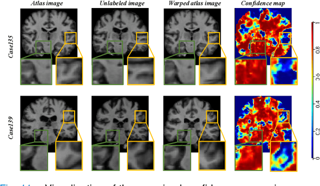 Figure 3 for StyleSeg V2: Towards Robust One-shot Segmentation of Brain Tissue via Optimization-free Registration Error Perception