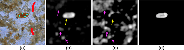 Figure 1 for Flyweight FLIM Networks for Salient Object Detection in Biomedical Images