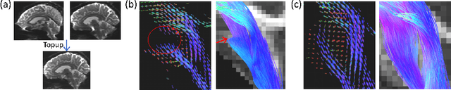 Figure 1 for Diffusion Model-based FOD Restoration from High Distortion in dMRI