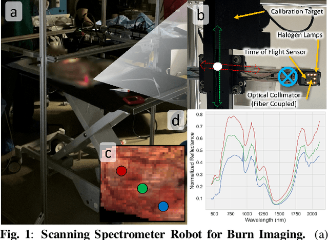 Figure 1 for Multimodal Optical Imaging Platform for Quantitative Burn Assessment