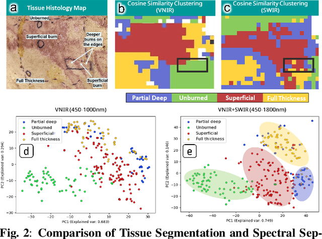 Figure 2 for Multimodal Optical Imaging Platform for Quantitative Burn Assessment