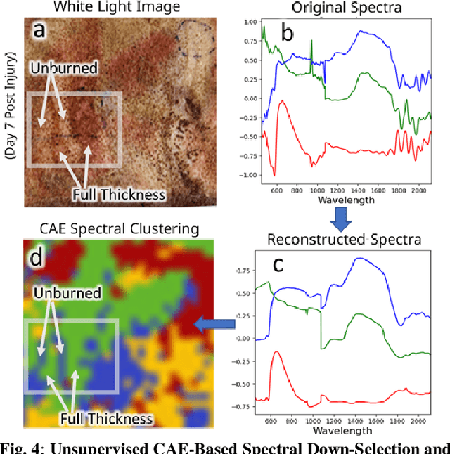 Figure 4 for Multimodal Optical Imaging Platform for Quantitative Burn Assessment