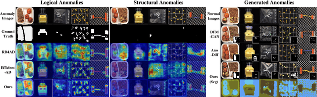 Figure 3 for Component-aware Unsupervised Logical Anomaly Generation for Industrial Anomaly Detection