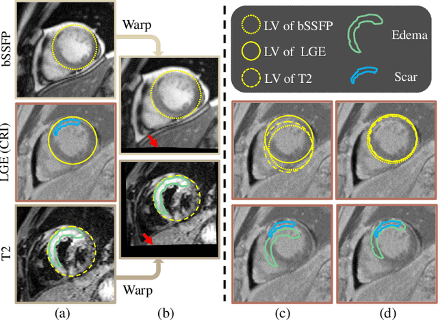 Figure 1 for Aligning Multi-Sequence CMR Towards Fully Automated Myocardial Pathology Segmentation