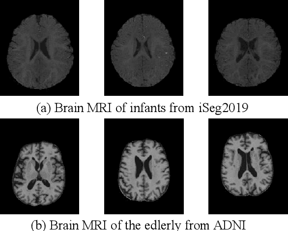 Figure 1 for Dual Meta-Learning with Longitudinally Generalized Regularization for One-Shot Brain Tissue Segmentation Across the Human Lifespan