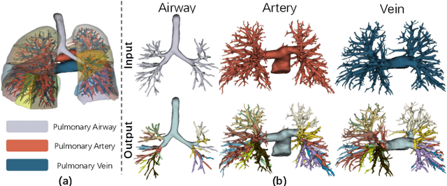 Figure 1 for Efficient Anatomical Labeling of Pulmonary Tree Structures via Implicit Point-Graph Networks