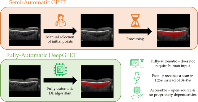 Figure 1 for Efficient and fully-automatic retinal choroid segmentation in OCT through DL-based distillation of a hand-crafted pipeline