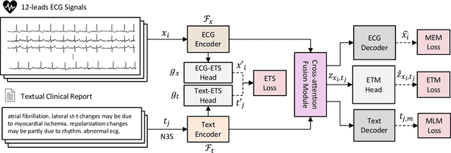Figure 1 for C-MELT: Contrastive Enhanced Masked Auto-Encoders for ECG-Language Pre-Training