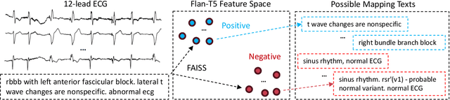 Figure 3 for C-MELT: Contrastive Enhanced Masked Auto-Encoders for ECG-Language Pre-Training