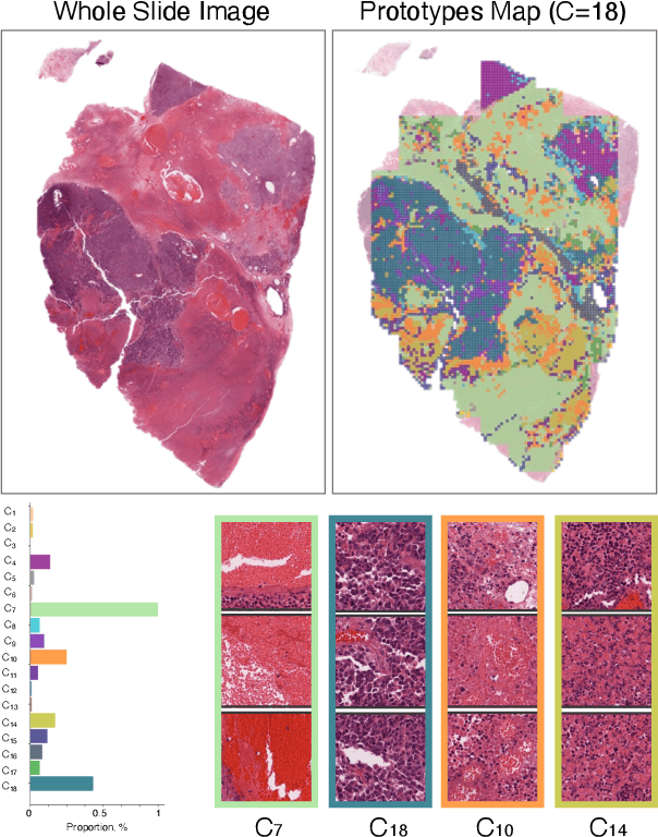 Figure 3 for Prototype-Guided Diffusion for Digital Pathology: Achieving Foundation Model Performance with Minimal Clinical Data