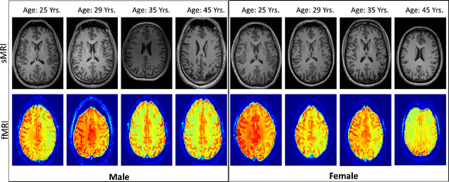 Figure 1 for Biological Brain Age Estimation using Sex-Aware Adversarial Variational Autoencoder with Multimodal Neuroimages