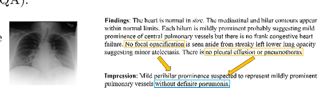 Figure 1 for Advancing Medical Radiograph Representation Learning: A Hybrid Pre-training Paradigm with Multilevel Semantic Granularity