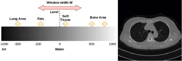 Figure 3 for Automated computed tomography and magnetic resonance imaging segmentation using deep learning: a beginner's guide